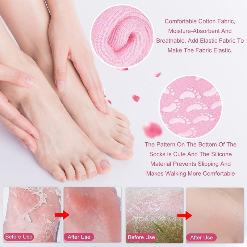 MASUM ENTERPRISE Silicone hydratant pour femmes et hommes pour pieds secs, talons fissurés, éliminateur de callosités,