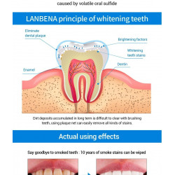 Instant 3D Teeth Whitening...