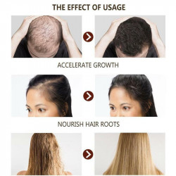 Disaar Fast Hair Growth...